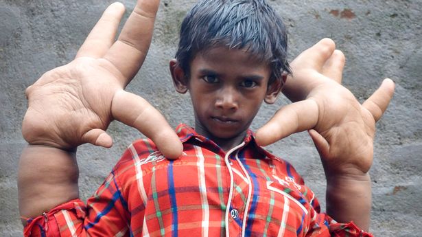 दुनिया के सबसे अजीबो गरीब बच्चे | MOST UNUSUAL KIDS IN THE WORLD